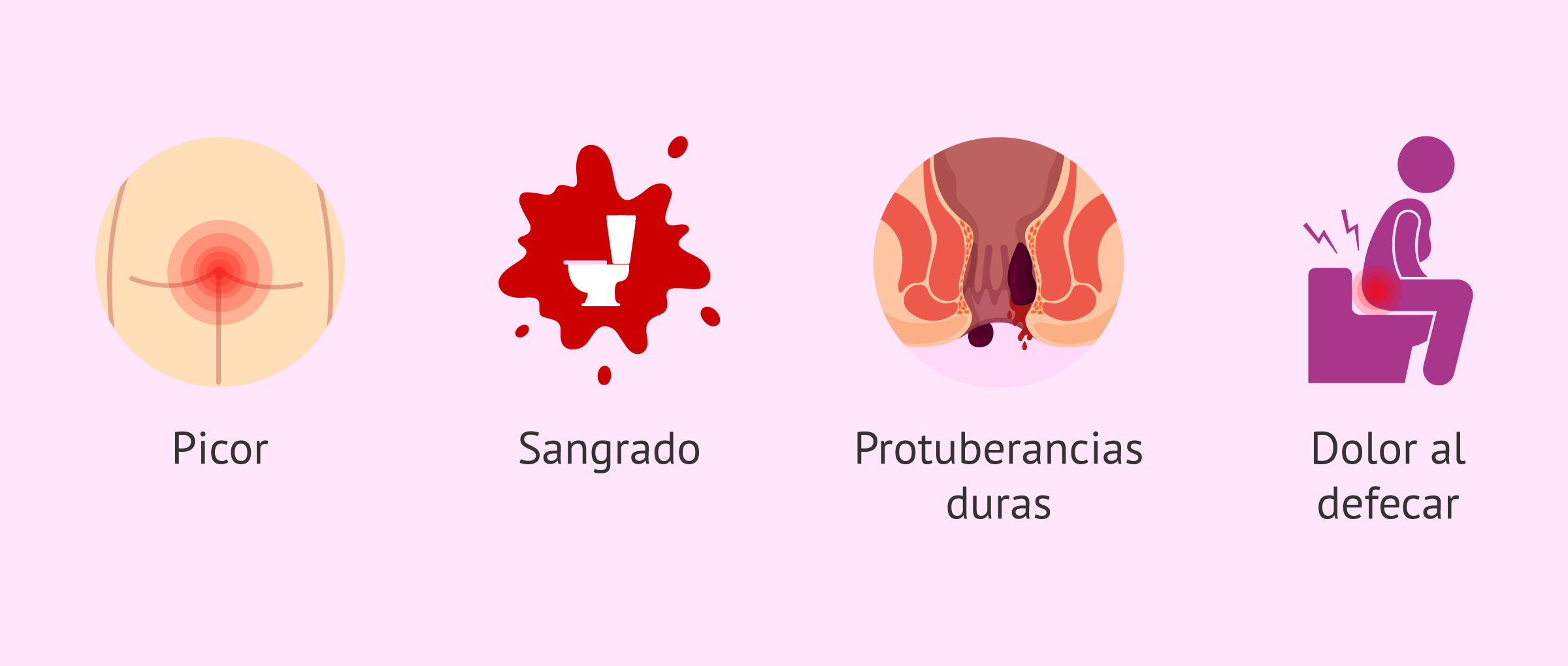 paciente hemorroides